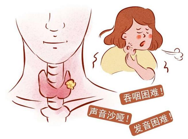 體檢時發(fā)現(xiàn)甲狀腺結節(jié)怎么辦？